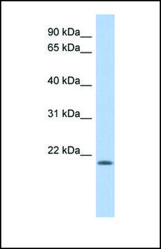 Anti-CHAC2, (N-terminal) antibody produced in