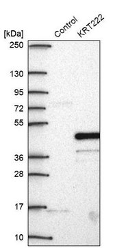 Anti-KRT222 antibody produced in rabbit