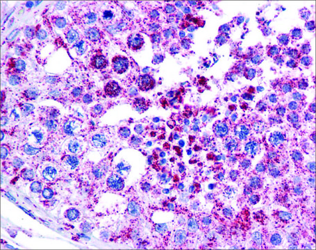 Anti-MAGEA3 antibody produced in rabbit