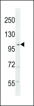 ANTI-RANBP17(N-TERMINAL) antibody produced in rabbit