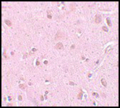 Anti-TINP1 antibody produced in chicken