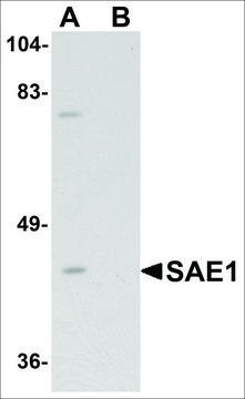 Anti-SAE1 antibody produced in rabbit