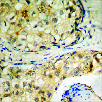 Anti-phospho-Tau (pThr²??) antibody produced in
