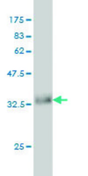 Monoclonal Anti-ACVR1B antibody produced in