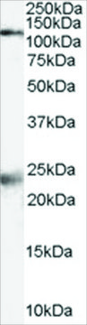 Anti-NMDA Receptor 1/GRIN1 antibody produced