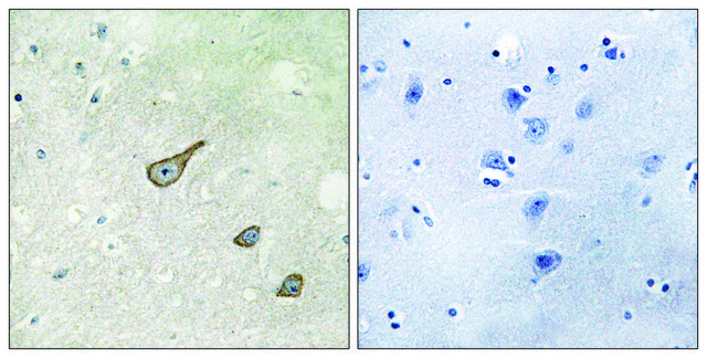 Anti-DGKK antibody produced in rabbit