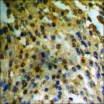 Anti-phospho-AurA (pSer³?²) antibody produced in