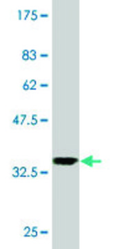 Monoclonal Anti-CHERP antibody produced in