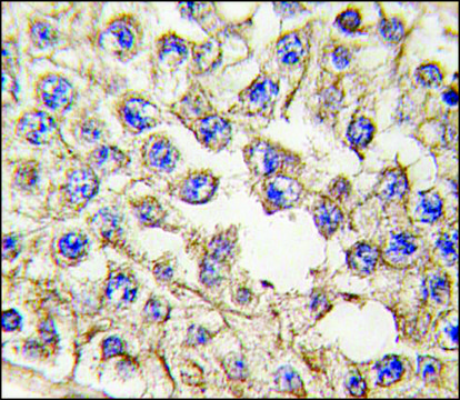 Anti-EPHA10 (center) antibody produced in