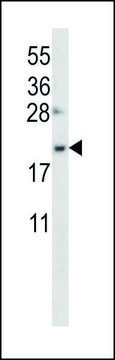 ANTI-OSTC (C-TERM) antibody produced in
