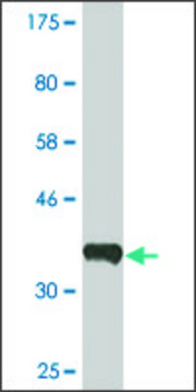 Monoclonal Anti-ERBB2IP, (C-terminal) antibody produced