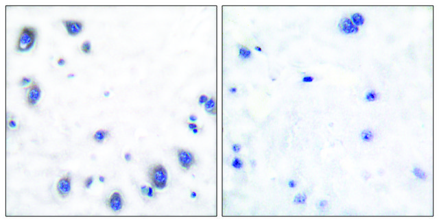 Anti-Tyrosine Hydroxylase, N-Terminal antibody produced