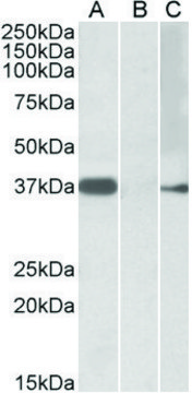 Anti-MYF6 antibody produced in goat