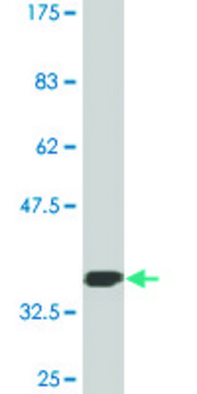 Monoclonal Anti-GLS, (C-terminal) antibody produced