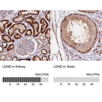 Anti-LDHD antibody produced in rabbit