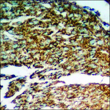 Anti-phospho-n-NOS (pSer??²) antibody produced in