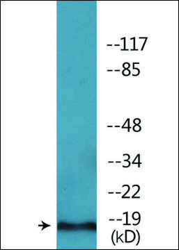 Anti-phospho-PEA-15 (pSer¹??) antibody produced in
