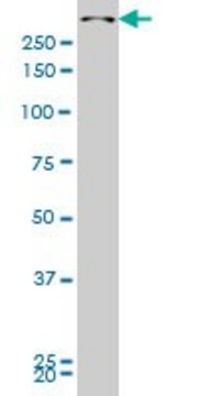 ANTI-SMG1 antibody produced in mouse