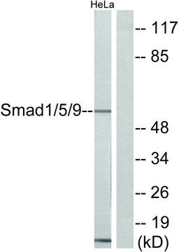 Anti-SMAD1 antibody produced in rabbit