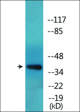 Anti-phospho-FOXL2 (pSer²?³) antibody produced in