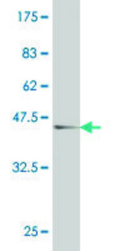 ANTI-ATOH1 antibody produced in mouse