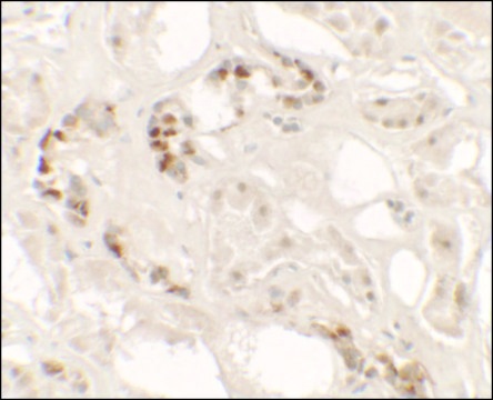 Anti-KANK2 antibody produced in rabbit