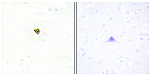 Anti-JAKMIP2 antibody produced in rabbit