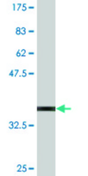 Monoclonal Anti-ZNF398, (N-terminal) antibody produced