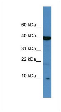 Anti-SPINK6 antibody produced in rabbit