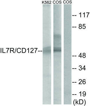 Anti-IL-7R antibody produced in rabbit