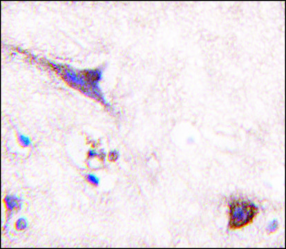 Anti-LZK (C-term) (S869) antibody produced