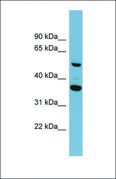 Anti-ADAMDEC1 antibody produced in rabbit