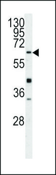 ANTI-GGTLA1(N-TERMINAL) antibody produced in rabbit