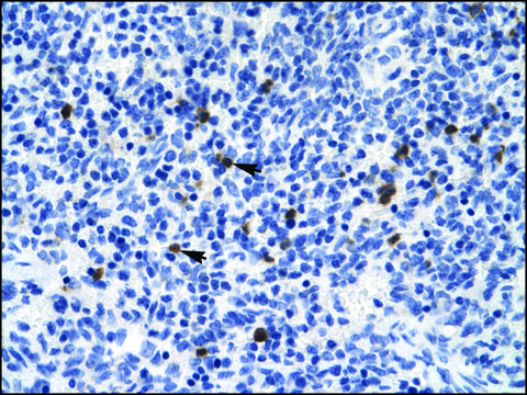 Anti-HTR3B antibody produced in rabbit