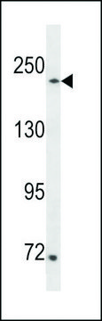 ANTI-SETD1A (CENTER) antibody produced in