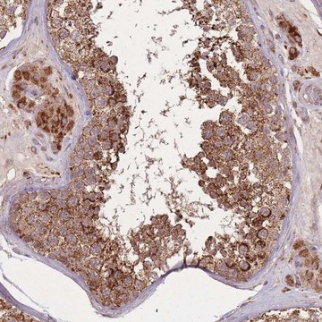 Anti-LYRM7 antibody produced in rabbit