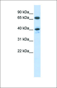 Anti-AGTR1 antibody produced in rabbit