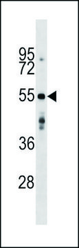 ANTI-AGPAT9 (CENTER) antibody produced in