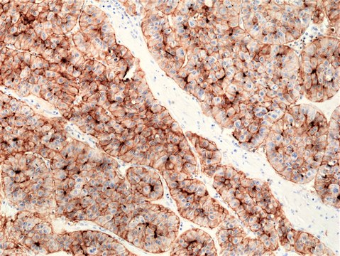 Anti-CD73 Rabbit Monoclonal Antibody