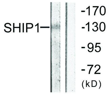 Anti-SHIP1 antibody produced in rabbit