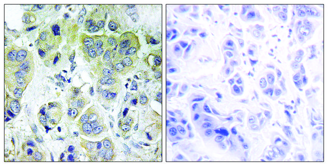 Anti-p70 S6 Kinase antibody produced