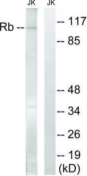 Anti-Retinoblastoma antibody produced in rabbit