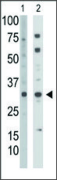 Anti-TK2 (C-term) antibody produced in