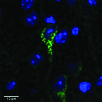 Anti-CRHR1/CRF-R (AA 107-117) antibody produced