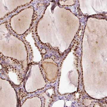 Anti-TOGARAM1 antibody produced in rabbit