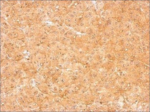 Anti-LOR (N-terminal) antibody produced in