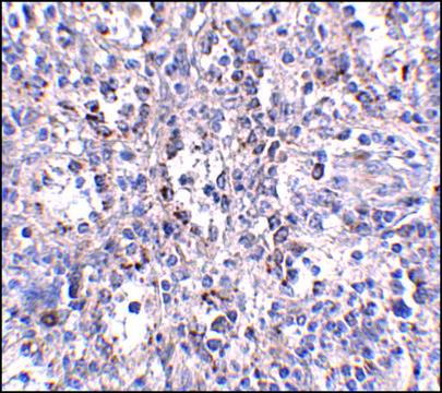 Anti-SCARB1 antibody produced in rabbit