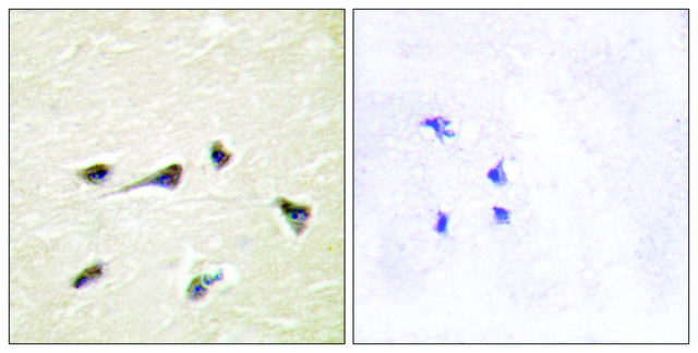 Anti-AKAP12 antibody produced in rabbit