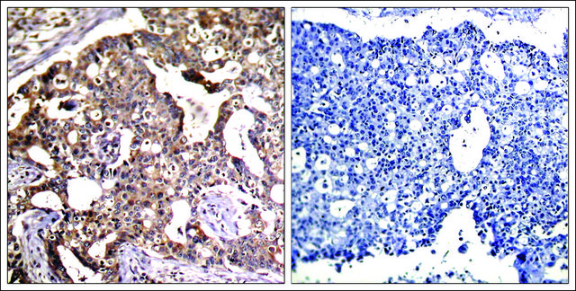 Anti-MAP2K4 (Ab-80) antibody produced in