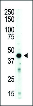ANTI-AURORA-B (ARK/STK12) (CENTER) antibody produced